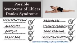 Possible Symptoms of Ehlers Danlos Syndrome
